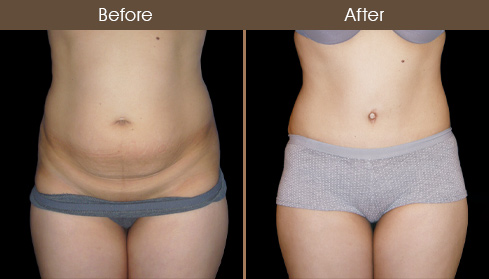 20202705151326_B6-Front-view